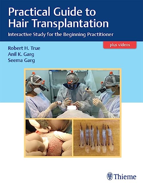 Practical Guide to Hair Transplantation-1판