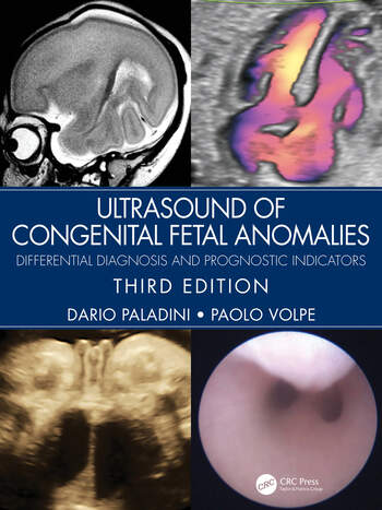 Ultrasound of Congenital Fetal Anomalies-3판
