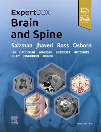 ExpertDDx: Brain and Spine-3판