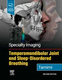 Specialty Imaging: Temporomandibular Joint and Sleep-Disordered Breathing-2판
