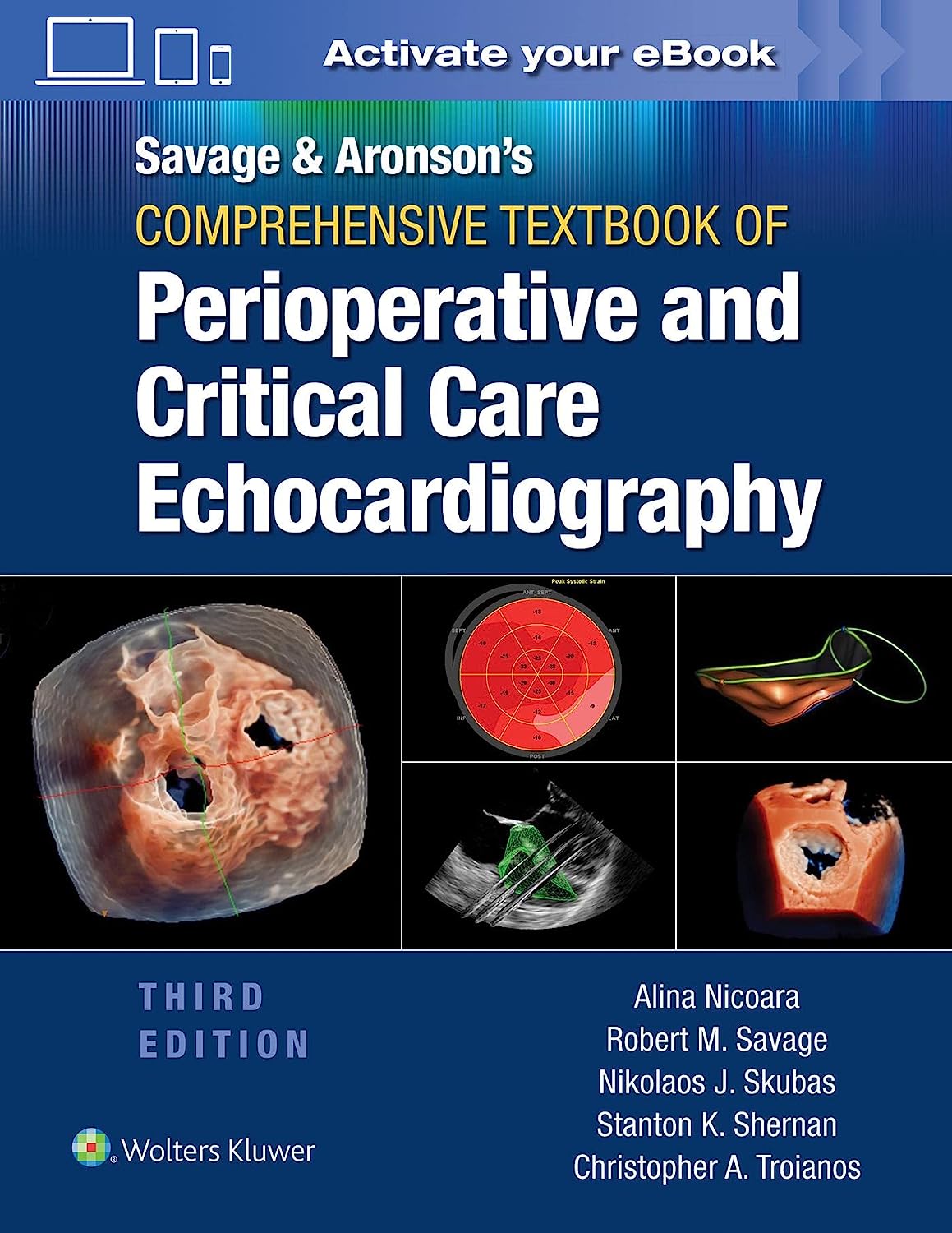 Savage & Aronson`s Comprehensive Textbook of Perioperative and Critical Care Echocardiography-3판