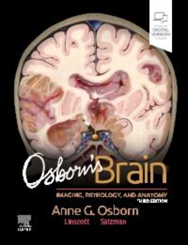 Osborns Brain-3판