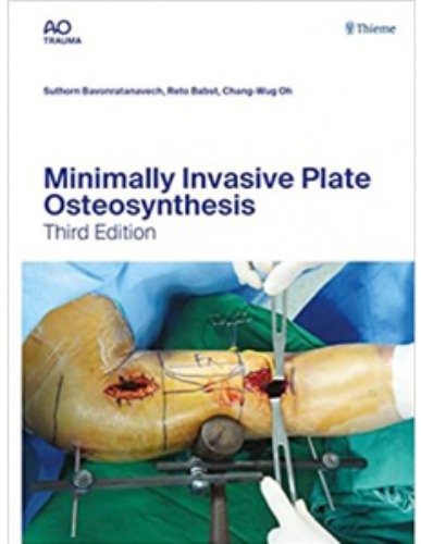 Minimally Invasive Plate Osteosynthesis-3판
