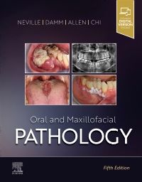 Oral and Maxillofacial Pathology-5판