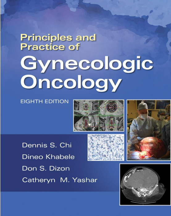Principles and Practice of Gynecologic Oncology-8판