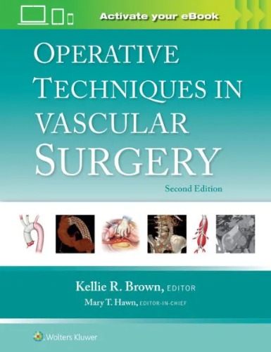 Operative Techniques in Vascular Surgery-2판