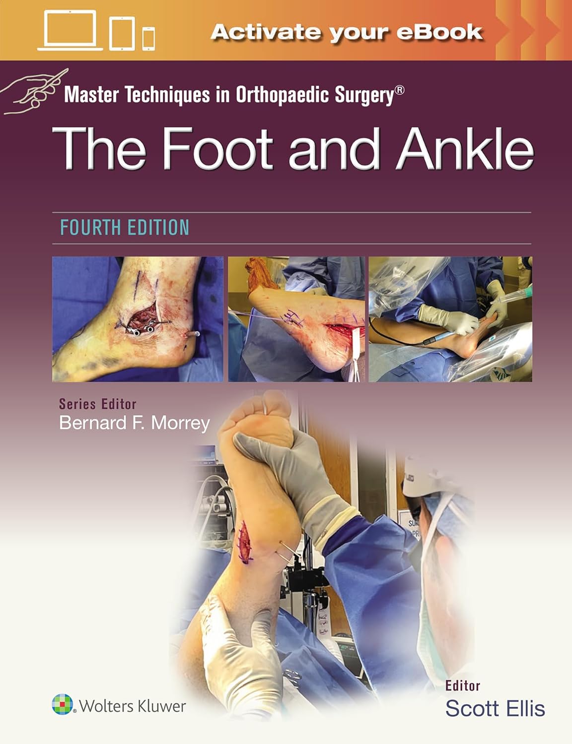 Master Techniques in Orthopaedic Surgery: The Foot and Ankle - 4판
