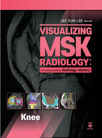 Visualizing MSK Radiology