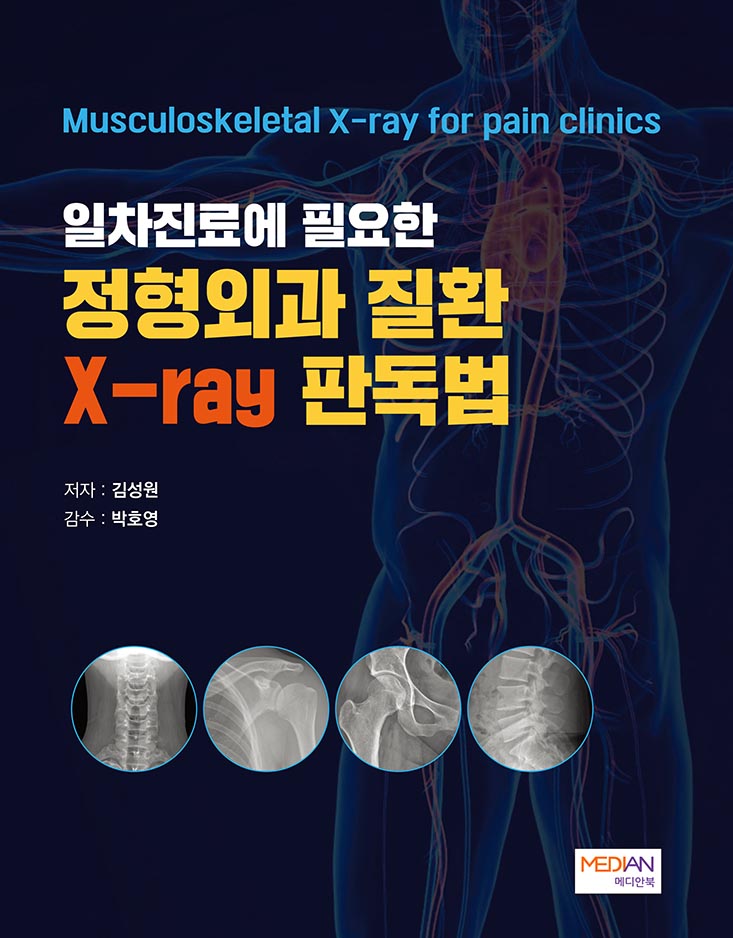 일차진료에 필요한 정형외과 질환 X-ray 판독법