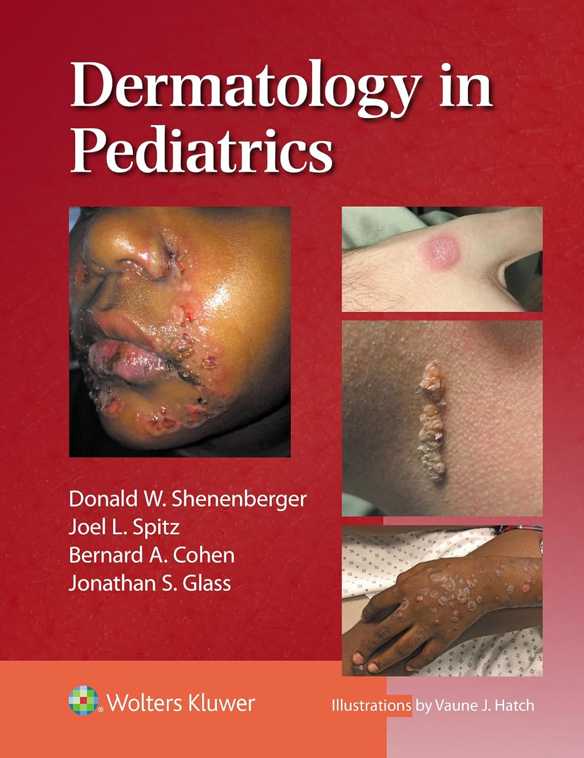 Dermatology in Pediatrics-1판