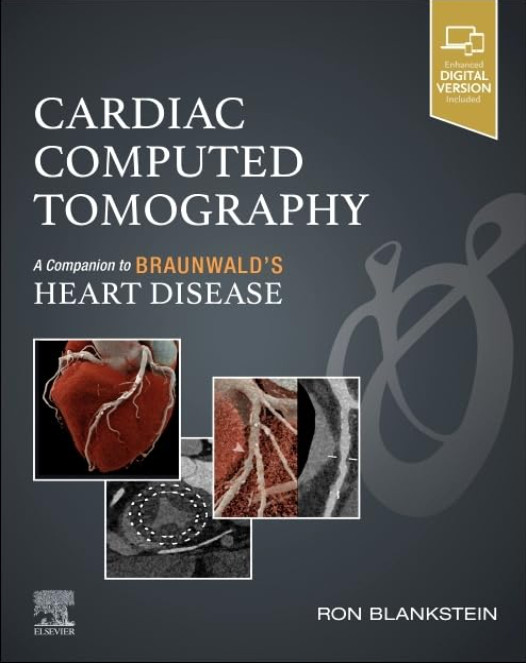 Cardiac Computed Tomography-1판