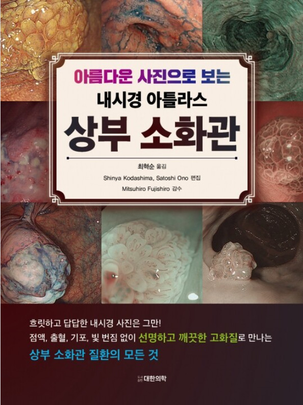 아름다운 사진으로 보는 내시경 아틀라스 상부소화관