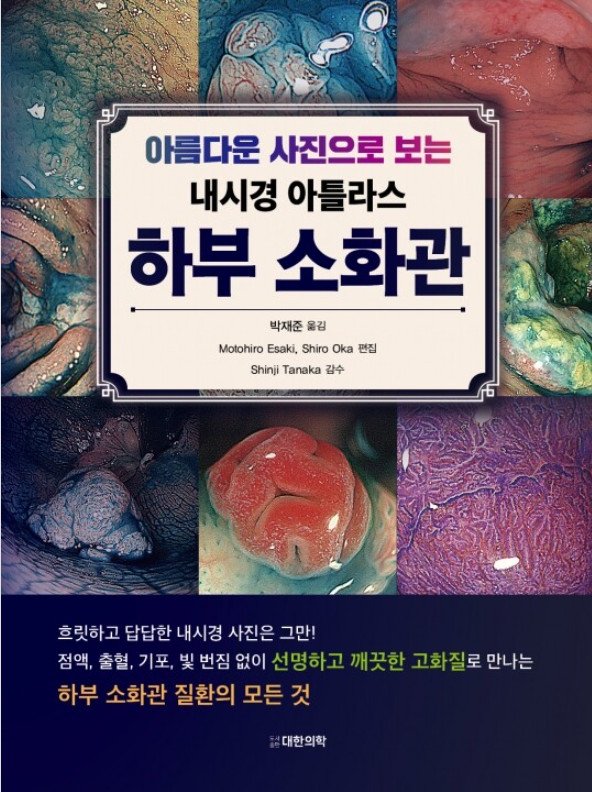 아름다운 사진으로 보는 내시경 아틀라스 하부소화관
