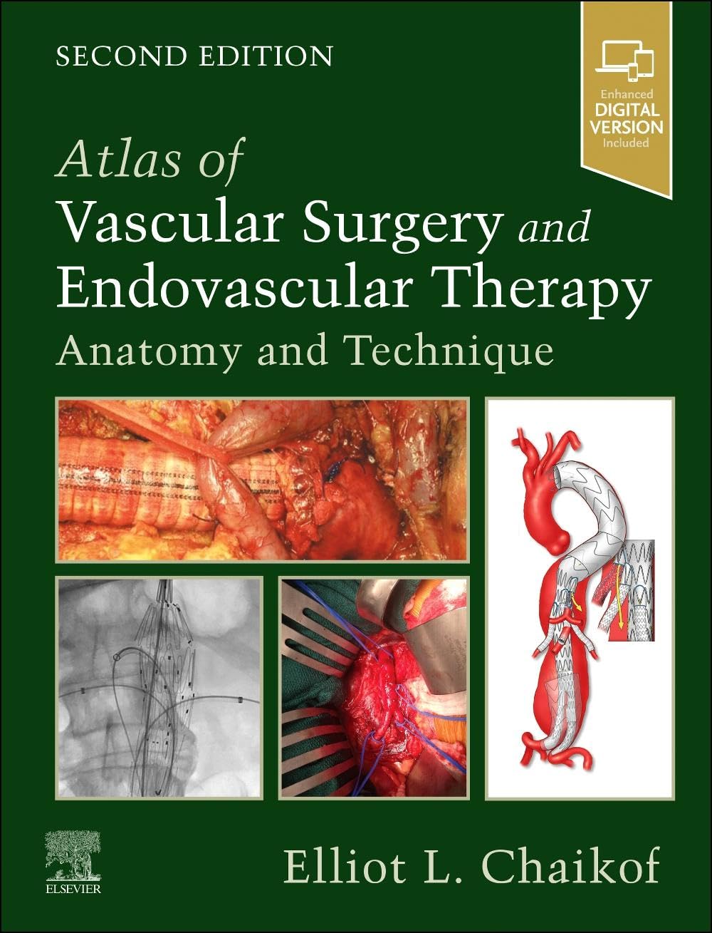 Atlas of Vascular Surgery and Endovascular Therapy-2판