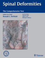 Spinal Deformities : The Comprehensive Text