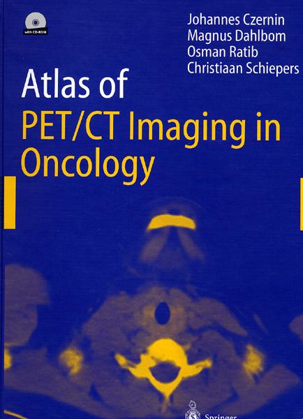 Atlas of PET/CT Imaging in Oncology - CD
