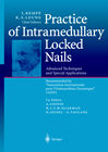 Practice of Intramedullary Locked Nails- Scientific Basis and Standard Technique