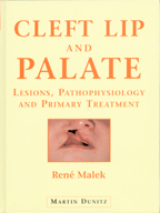 Cleft Lip and Palate: Examination Surgery and Rehabilitation