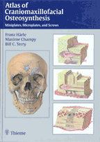 Atlas of Craniomaxillofacial Osteosynthesis : Microplates Miniplates and Screws