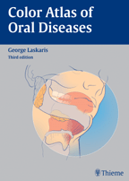 Color Atlas of Oral Diseases 3e