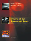 Imaging of the Scrotum and Penis