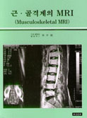 근골격계의 MRI