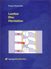 Lumbar Disc Herniation