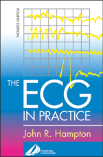 ECG in Practice The 4/e