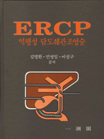 ERCP역행성담도췌관조영술