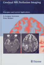 Cerebral MR Perfusion Imaging: Book + CD-ROM Set