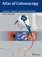 Atlas of Colonoscopy : Techniques. Diagnosis. Interventional Procedures